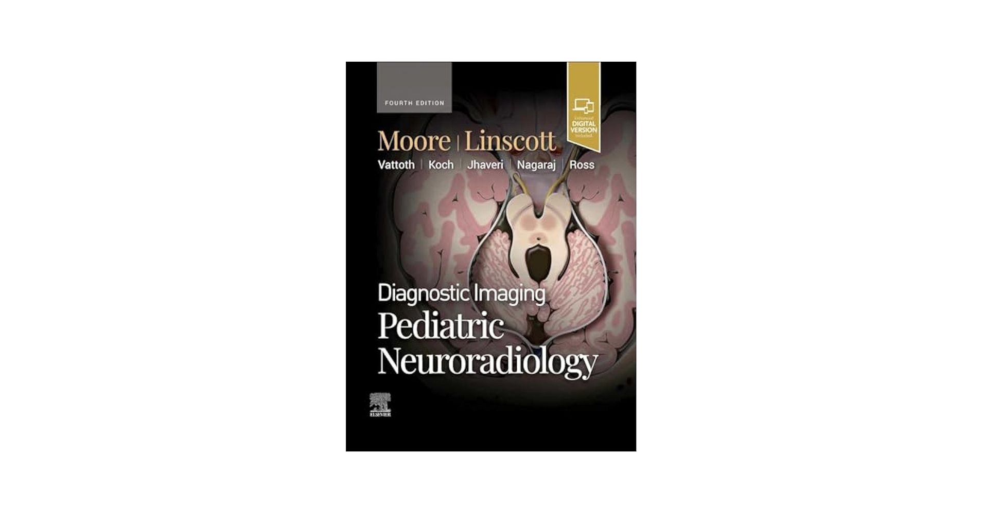 Diagnostic Imaging: Pediatric Neuroradiology: 9780443234927