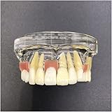 Zoom IMG-1 uqachg riparazione denti modello istruzione Zoom IMG-1 uqachg riparazione denti modello istruzione