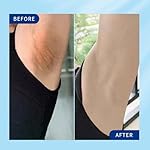 Skin Whitening Cream, Intimate Bleaching Cream for Women, Skin Lightening for Dark Spots, Private Parts, Underarms, Elbows, Armpits, Knees, Inner Thighs - Image 4