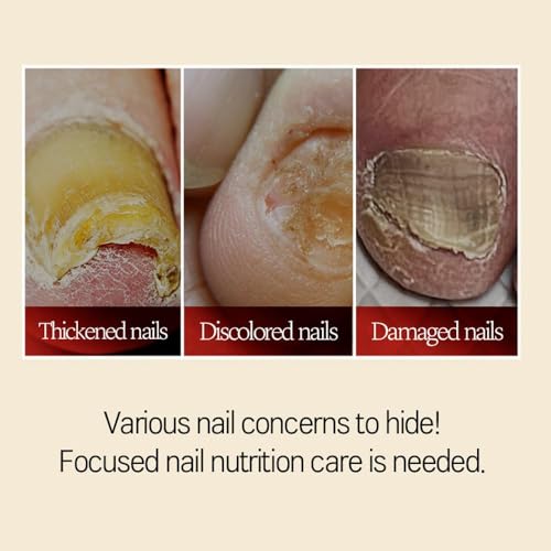 Safepick Intensive Nail Strengthener Serum for Weak, Thin & Damaged Fingernails - Keratin & Biotin Formula for Restoration & Growth Support - Quick-Drying - Image 4