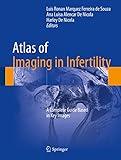  Atlas of Imaging in Infertility: A Complete Guide Based in Key Images (English Edition)