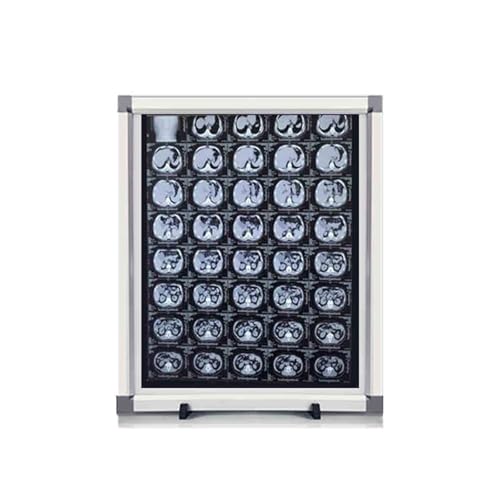 GMBAYUE Professional X-Ray Film Light Box X-Ray Viewer LED Light Panel Lab Equipment, 0-100% Adjustable Brightness, No Shadows for Clinic Hospital & Lab Use(16x19x03in/41x47.5x1cm)