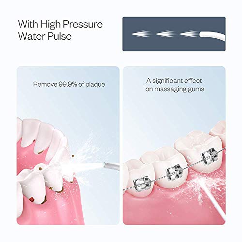 Water Flosser Cordless for Teeth, Anjou 300ML Professional Dental Oral Irrigator, Portable and Rechargeable IPX7 Waterproof Powerful Battery Life Teeth Cleaner for Home Travel, Braces and Bridges Care - Thumbnail 7