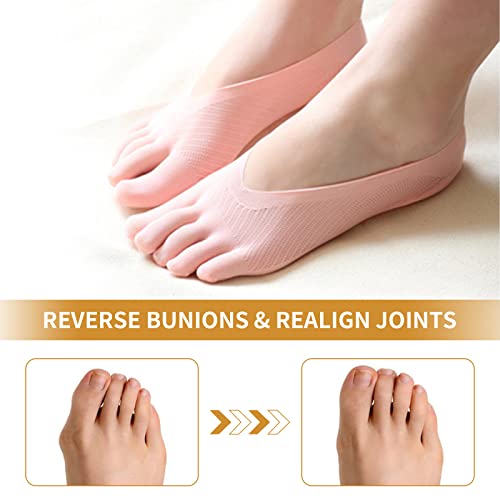 Amebae 6 Pairs No Show Toe Socks, Projoint Antibunions Health Sock, Invisible Non-Slip Toe Socks For Women Five Finger Socks (3Black+3Skin) #TOP3