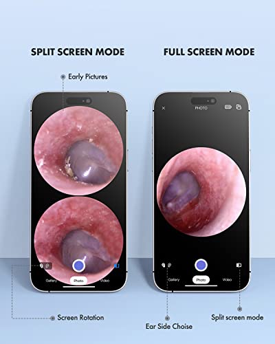 Anykit-Wireless-Otoscope-Ear-Camera-with-Dual-View-39mm-720PHD-WiFi-Ear-Scope-with-Ear-Wax-Removal-Tool-for-Kids-and-Adults-Pets-Compatible-with-Android-and-iPhone