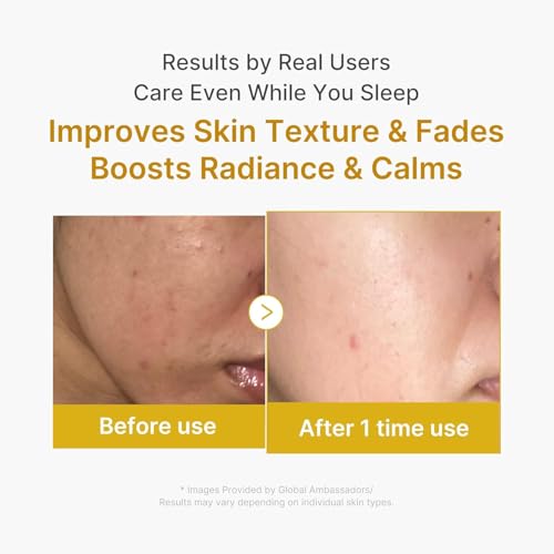 Image of Kojic Acid Turmeric Overnight Face Mask | Wrapping Peel Off Night Mask | Brightening & Hydrating Skincare Overnight Wrapping Peel Off Mask with Kojic Acid & Turmeric