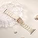 Lerobo Resin Band Compatible with Apple Watch Bands for Women 38mm 40mm 41mm 42mm, Fashion Lightweight Tortoise Replacement Strap for iWatch Series 11 10 9 8 7 6 5 4 3 2 SE Ultra, Colorful Ivory White