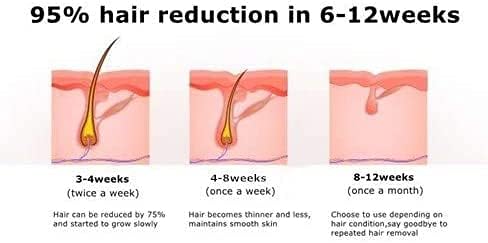 Miniatura 8 de MiSMON - Depilación láser de compresa de hielo para mujeres, dispositivo de depilación permanente IPL para cuerpo, bikini, uso doméstico seguro,