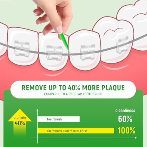 Annauiy 80 Stück Interdentalbürsten,Gemischt Größe 0,6/0,7/0,8/1,0-1,2mm-Für Zahnreinigung Zwischenräume,Zahnspangenreiniger,Zahnzwischenraumbürste,Häusliche Nutzung – Bild 7
