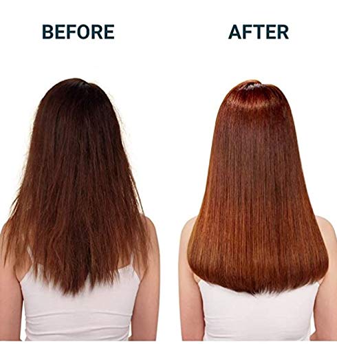 Anti Hair Loss Organic Suntree Shampoo 10.13 fl.oz.(300ml) & Treatment The premium 7.1 fl.oz.(210ml) Set (ALLEVIATEING HAIR LOSS SYMPTOMS FOR WOMEN & MEN, DAMAGED HAIR CARE, VOLUMIZING HAIR)