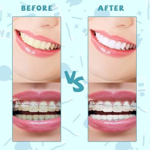 Image of 100PCS Interdental Brushes Between Teeth for Braces, Flossers Brush Cleaner, Orthodontic Flossers for Braces Cleaning Kit, Dental Teeth Cleaning Tools (Bright Colors, Multiple Sizes