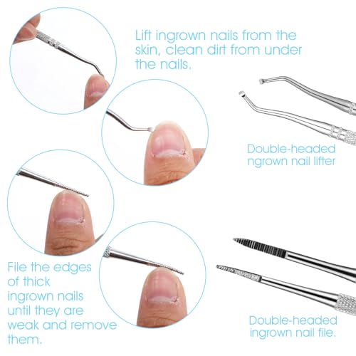 Wanmu Kit de remoção de unhas encravadas com 7 peças, lixa de unha encravada cirúrgica profissional