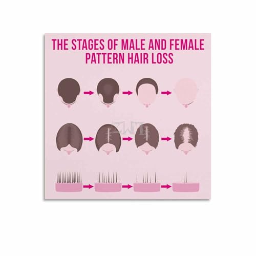 Hair Loss Stages Chart Poster, Canvas Wall Decor 16x16in
