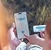 iTOVi Scanner