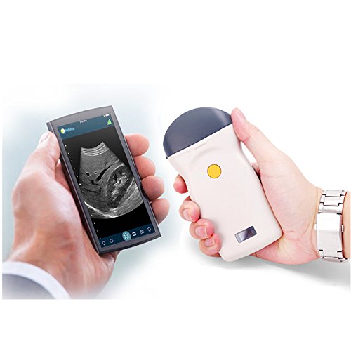 Wireless Ultrasound Scanner, Pocket WiFi Veterinary Pregnancy Ecograph with 3.5 Mhz/80 Element Convex