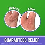 O'Keeffe's Working Hands Night Treatment Hand Cream for Extreme Dryness - 7 oz Tube (1 Pack) - Repairing Skincare for Cracked, Dry Hands - Image 2