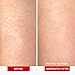 First Aid Beauty - KP Bump Eraser Body Scrub with 10% AHA, Keratosis Pilaris Exfoliator with Glycolic and Lactic acids, Helps Reduce Chicken Skin Bumps, Safe for Sensitive Skin, Strawberry Scent, 2 oz