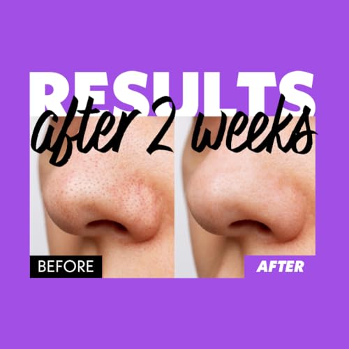 Nosca9 Deep Pore Cleansing Foam for Sensitive Skin | Korean Skincare Face Wash with 17 Amino Acids, White Clay & Patented Pore-Shrinking Ingredient | Deep Cleansing & Moisturizing - Image 7