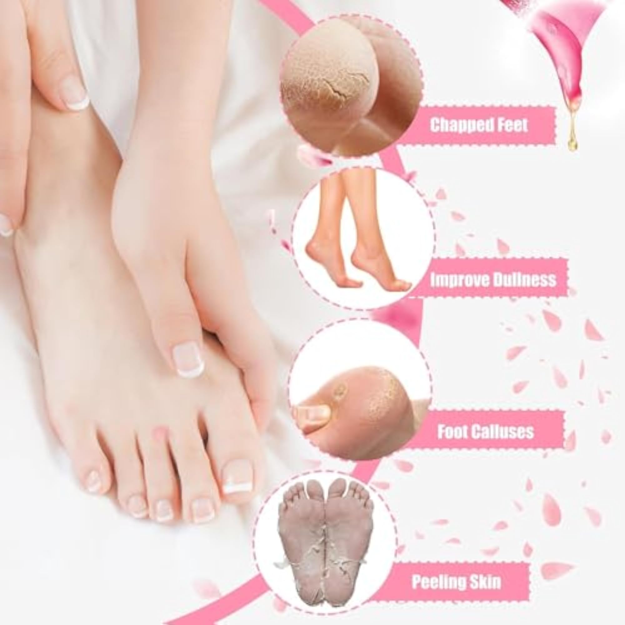 Lifestyle Silicone Socks for Cracks for Women & Men