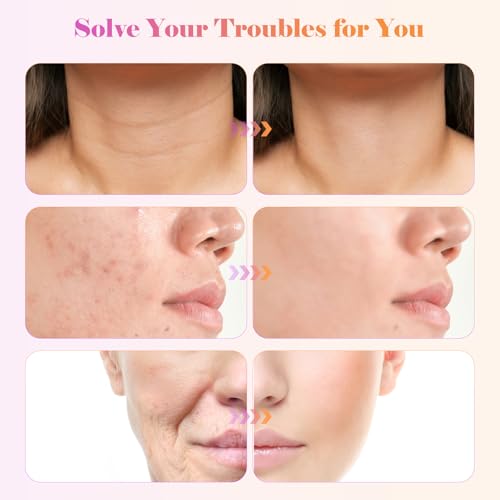 Hochfrequenz-Stab, iklestar Hochfrequenz Gerät Haare mit 6 Glasröhren, Handheld Gesichtsmaschine Kit für den Heimgebrauch