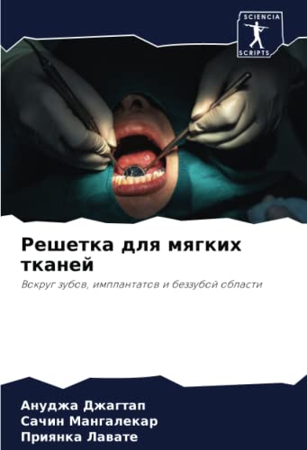 Решетка для мягких тканей: Вокруг зубов, имплантатов и беззубой области (Russian Edition)