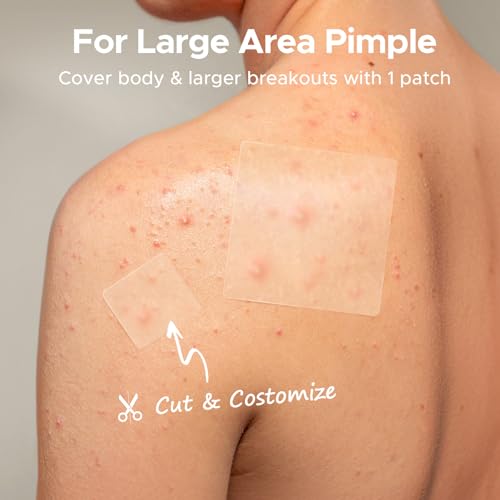 TKTK Adesivos grandes de espinhas, adesivos de acne GG de 60 mm, bandagens hidrocolóides grandes par