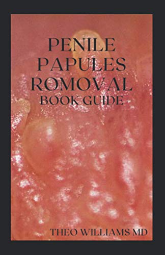 PENILE PAPULES ROMOVAL BOOK GUIDE: The Ultimate Guide On How To Remove Pearly Penile Papules Using Natural Remedies