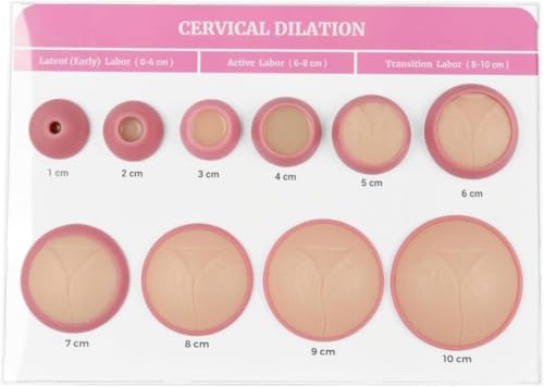 Simulador de enseñanza obstétrica y dilatación cervical de 1-10 cm para parteras