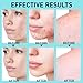 Acne Gel for Cystic & Hormonal Treatment: Max Strength with Salicylic Acid & Azelaic Acid, Blemish Remover, Pimple Cream for Teens & Adults | Face, Body & Back| 1.0 oz
