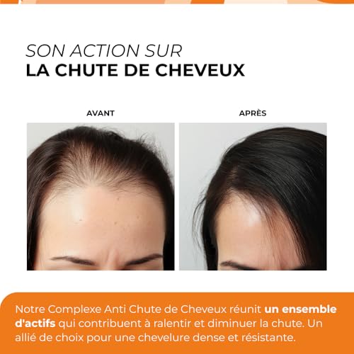Perte de cheveux solution anti-chute CUURE AnaGain - 5