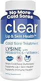 Lysine Cold Sore Treatment for Lips with Pre-Probiotics & VIT C | 1 Month Supply | Supercharged Lysine Capsules with Rhamnosus & Acidophilus for Cold Sores Relief, Skin + Gut Health & Immune Support