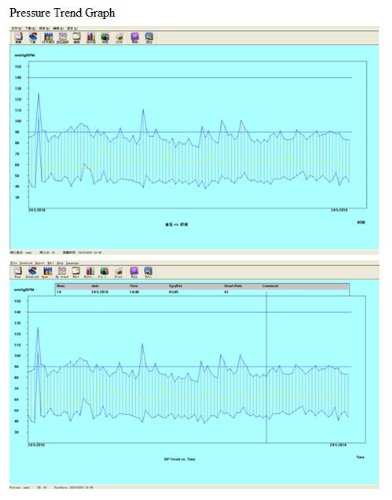 Contec08A Digital Upper Arm Blood Pressure Monitor, Pulse Rate & Spo2 Meter - One Machine, Multiple Functions #TOP5