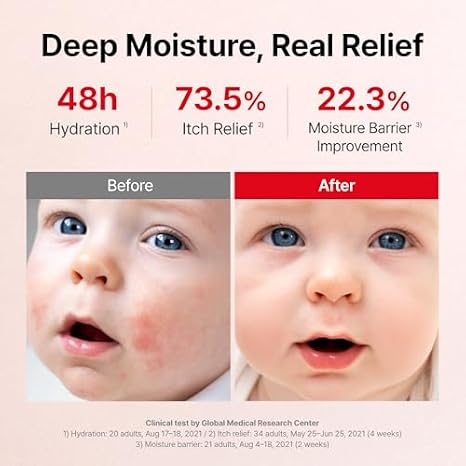 ATOPALM MLE Eczema Cream 65ml and 160ml Bundle