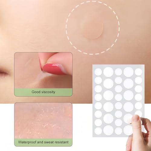 TIKIYOUN Adesivos de espinhas para acne hidrocolóide facial para cobrir espinhas e manchas, 2 tamanh