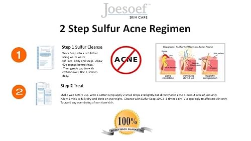 Joesoef Skin Care Sulfur Soap For Acne Pharmaceutical Grade Dermatologists Approved For Acne Rosacea 100G #TOP4