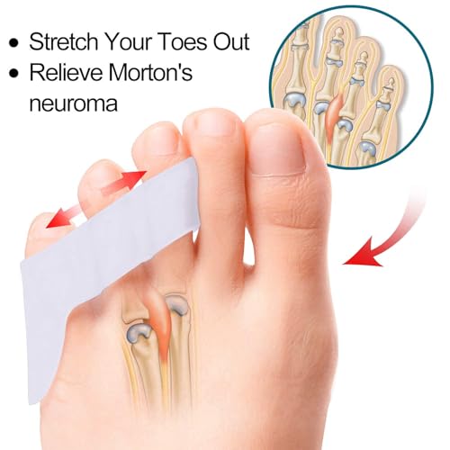 Image of Toe Separator for Feet Toe Spacers Correct Toes Yoga Silicone Hammer Toe Corrector for Women & Men Correct Toe Straighteners for Overlapping Toes (All Finger Toe Separator) (PRO)