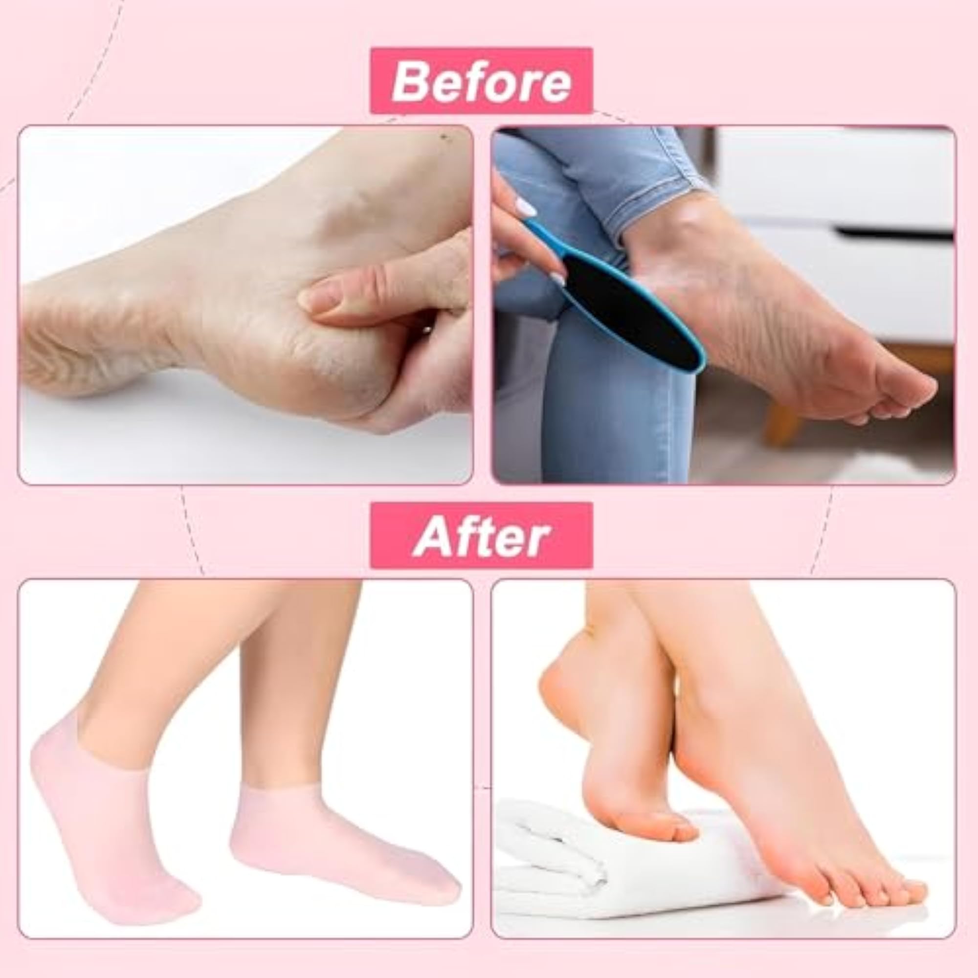 Silicone Gel Socks for Cracked Heels