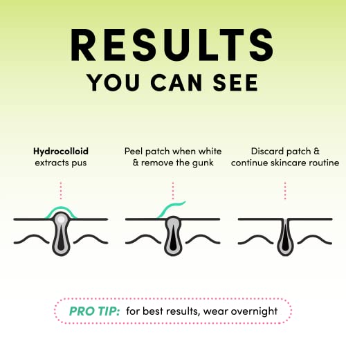 image for Dots for Spots Pimple Patches for Face - Pack of 24 Hydrocolloid Acne 