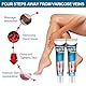 Wonsters 2pc Krampfadern Creme, Venensalbe Creme Gegen Krampfadern, Varicose Veins Cream, Varicose Veins Relief Cream, Venensalbe Creme Gegen Krampfadern