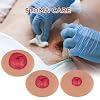 Sticky Colostomy Simulators, Stoma Training Model Set, Multi-Skin Tone Ostomy Care Practice Models for Medical Training and Patient Education- Tan