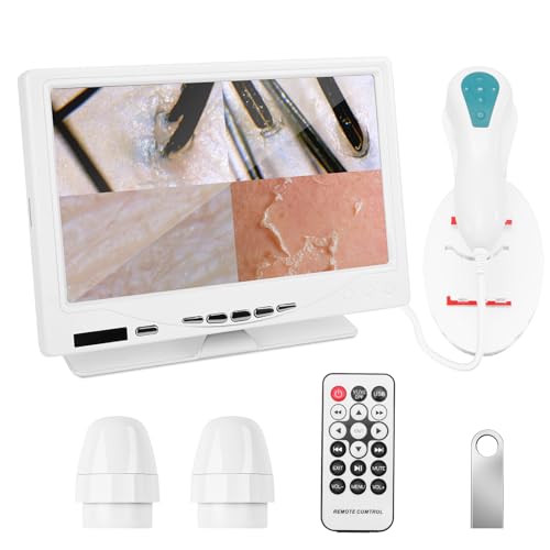 Beauty Star 7-Inch Scalp & Skin Analyzer with 50X/200X Dual Lenses 4-Split View & 16GB Storage HD Trichology Microscope Camera for Professional Salon Head Spa and Home Hair Follicle Health