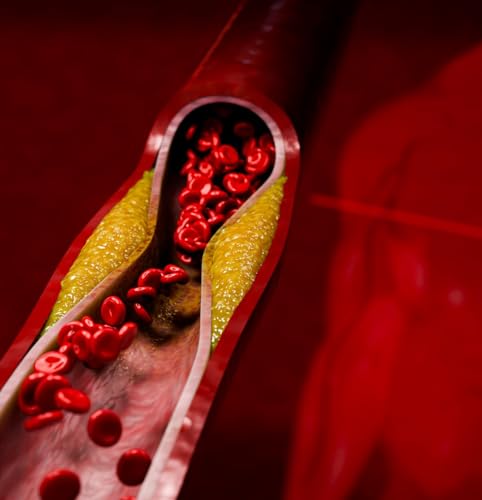 Troponin-Negative Chest Pain: A Dangerous Illusion