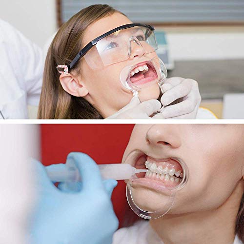 Vicloon 12Pcs Mundöffner Spiel Weihnachten, Wangenhalter Fuer Mundöffner Challenge, Dental C-Form für Weihnachten Partyspiele und Zahnaufhellung