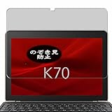 pantalla toshiba satellite precio Alta función automática de reparación, Cualquier burbuja y arañazos desaparecerá automáticamente en 48 horas.