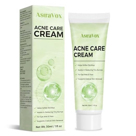 Crema Acne, Crema Antiacne, Combate Eficazmente el Acné, Los Granos y Los Puntos Negros, Alivia Rápidamente el Enrojecimiento de la Piel, Apta Para Todo Tipo de Piel, Ingredientes Suaves