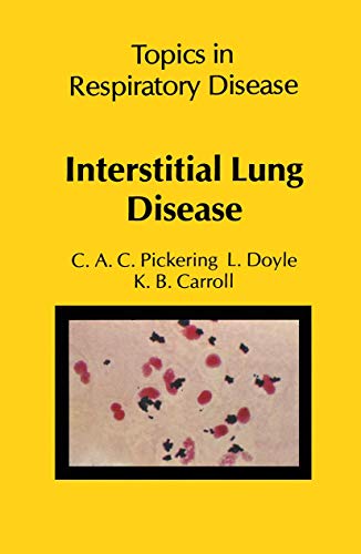 Interstitial Lung Disease view 2