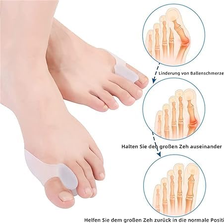 Fitaza Gel Bunion Corrector Toe Separators - Bunion Support, Splint for Overlapping Toes Straightener 2