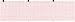 ECG Paper 80MM X 90MM X 360Sheet (Works for HELLIGE Contrast, MAC 400, MAC 600, 2030887-001) (5)