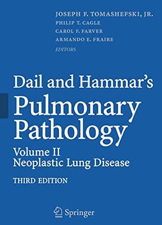 Dail and Hammar's Pulmonary Pathology: Volume II: Neoplastic Lung Disease Third Edition 2008 Edition-Wow! eBook