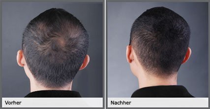 BIOTHIK Haaraufbau-Faser S8 wheat blond 25g Alkoholfrei Pulver Haarwuchs und Haarverdickung Unisex-Erwachsene